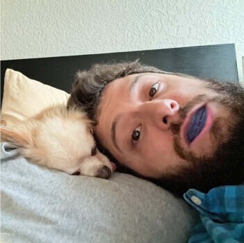 Jeremytis Anti Snoring Device image