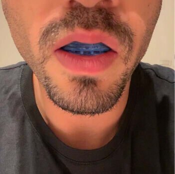 Jeremytis Anti Snoring Device image